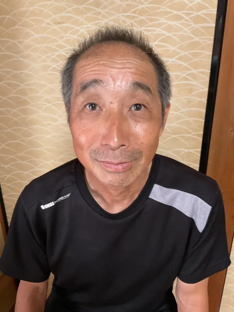左顎関節症(頭蓋骨の調整・薄毛の変化 乞うご期待)